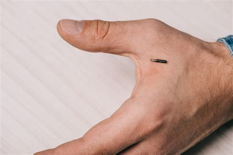 will microchips be banned